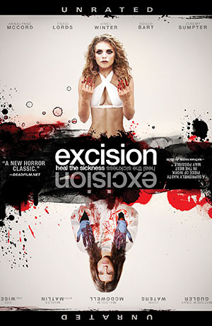 Excision
